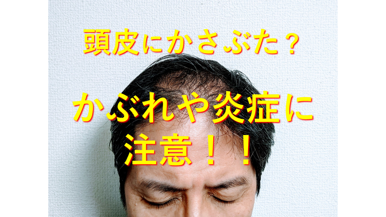 皮膚マニアの治療方法